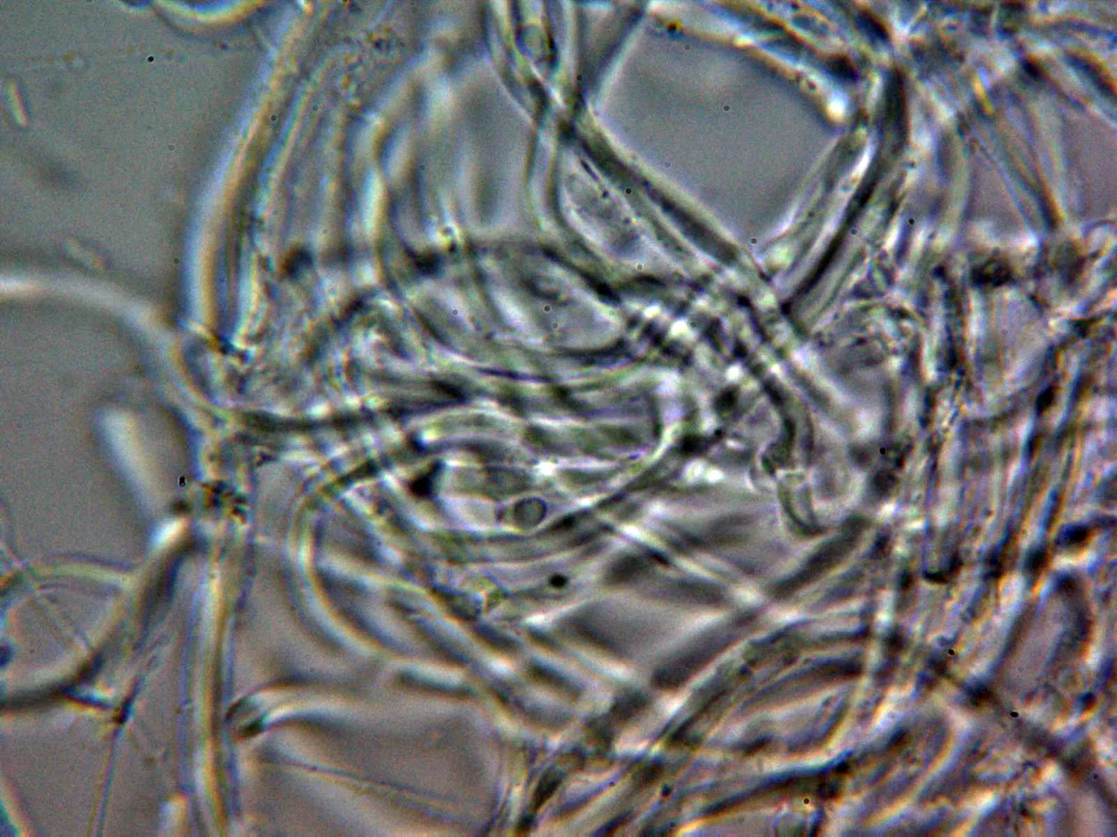 Microscopía de Cystidiopostia hibernica - 10 - Hifas contexto KOH fibuladas